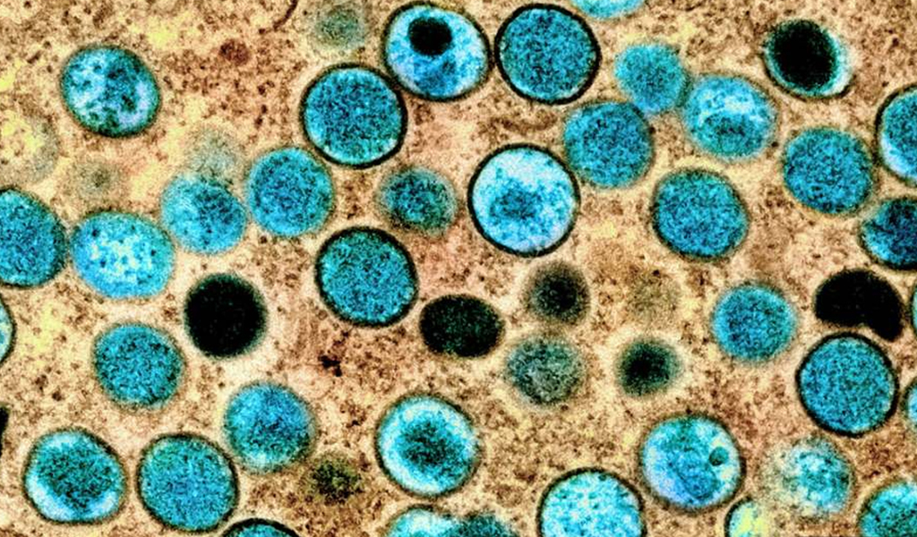This is an image of the MPox virus. It is a series of blue circles against a brown background.